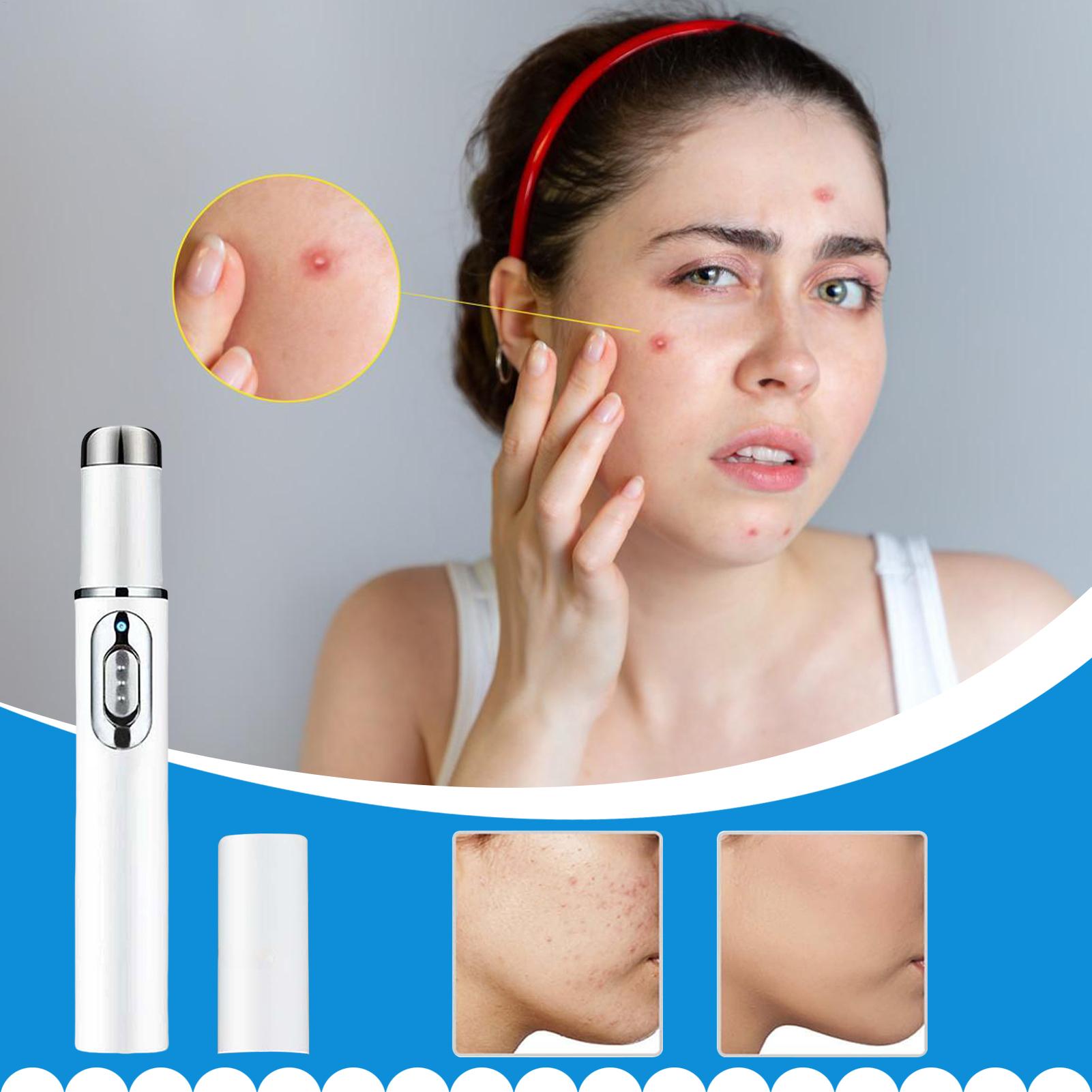 Mole Remover Pen Portable Skin - Women Accessories Combo recension och pris